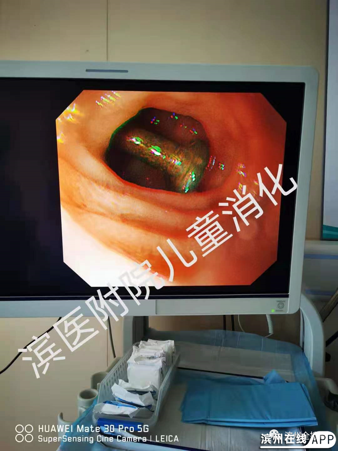 Yk7P78K464bP2b50.jpg